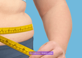 कसरी घटाउने मोटोपना ? मोटोपनाले पैदा गर्ने रोग के हुन् ? #Obesity