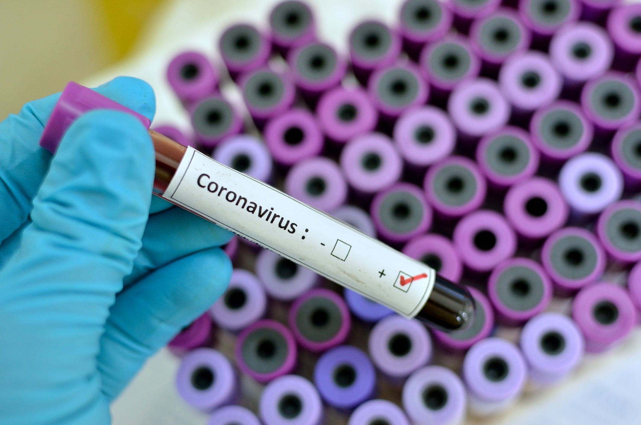 coronavirus vial 1