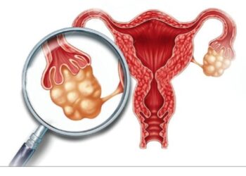 पाठेघरको मुखको ‘क्यान्सरको स्क्रिनिङ गर्दा एक सय १० मध्ये चार जनाको ‘पोजेटिभ’
